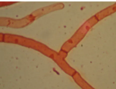 Gambar 3.  Fusarium sp.