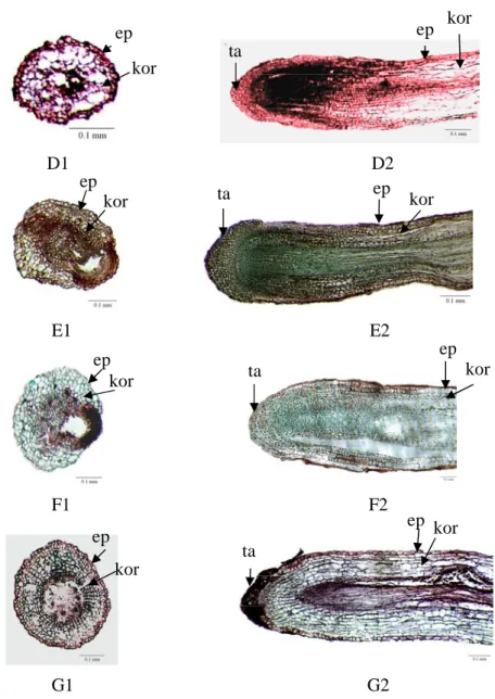 Gambar  4  Anatomi  ujung  akar  M.  malabathricum  yang  mendapat  perlakuan  beberapa  konsentrasi  Al  pada  pH  3  selama  8  minggu  perlakuan