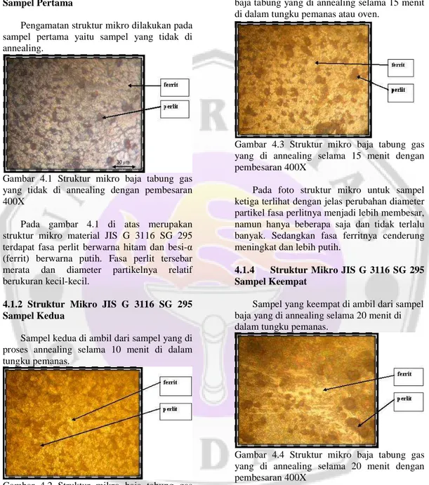 Gambar  4.1  Struktur  mikro  baja  tabung  gas  yang  tidak  di  annealing  dengan  pembesaran  400X 