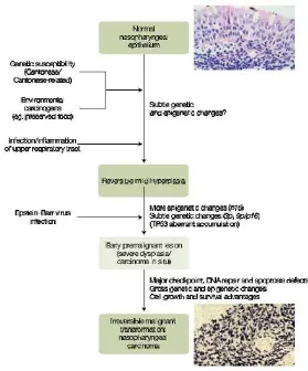 Gambar 2. Patogenesis karsinoma nasofaring (Dikutip dari: Tao Q, Anthony TC Chan. Nasopahryngeal Carcinoma: Molecular Pathogenesis and TherapeuticDevelopments in Expert review in molecular  medicine