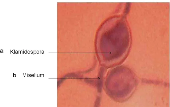 Gambar 1. Bentuk klamidospora pada jamur pythium                                                                                      a.Klamidospora b.Miselium  spp