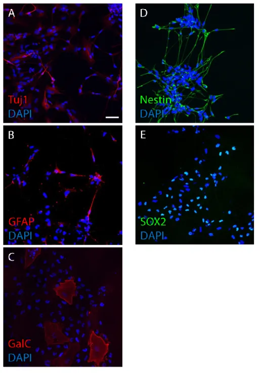Fig. 1-6 Neural stem cell culture. (A: neurons, B: astrocytes, C: oligodendrocytes, D,  E: neural stem cells) (Scale bar, 50 μm) 