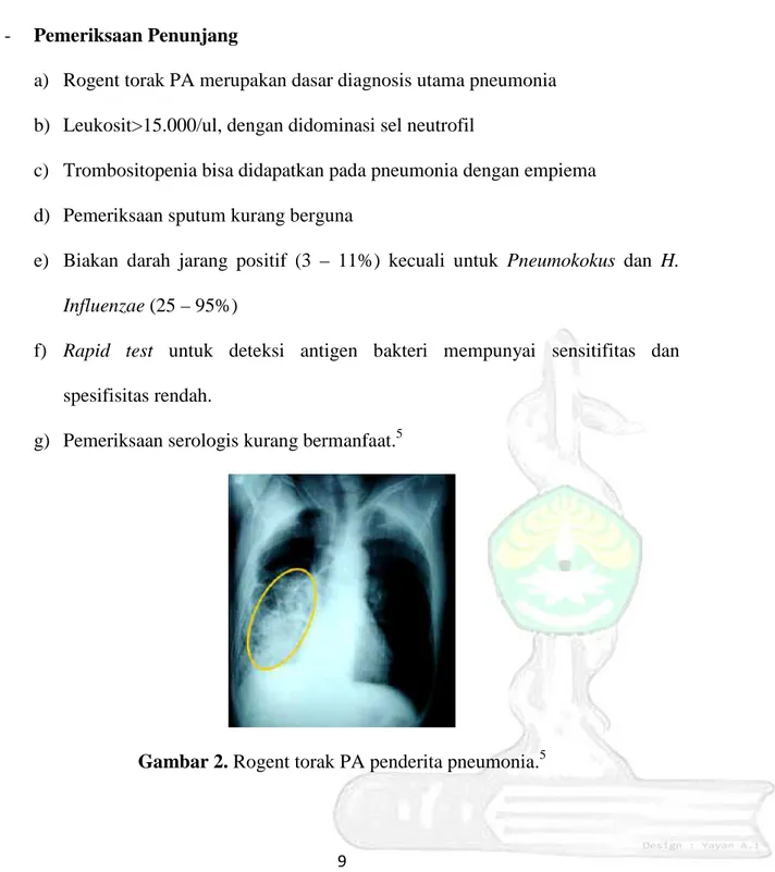 Gambar 2. Rogent torak PA penderita pneumonia. 5