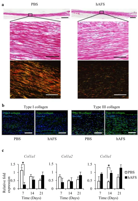 Fig. 4    hAFS treatment altered  collagen organization in the  regenerated tissues 21 days after  treatment