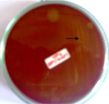 Gambar 2 Hasil  uji  gula-gula  bakteri  Streptococcus  equi  (URR1). 
