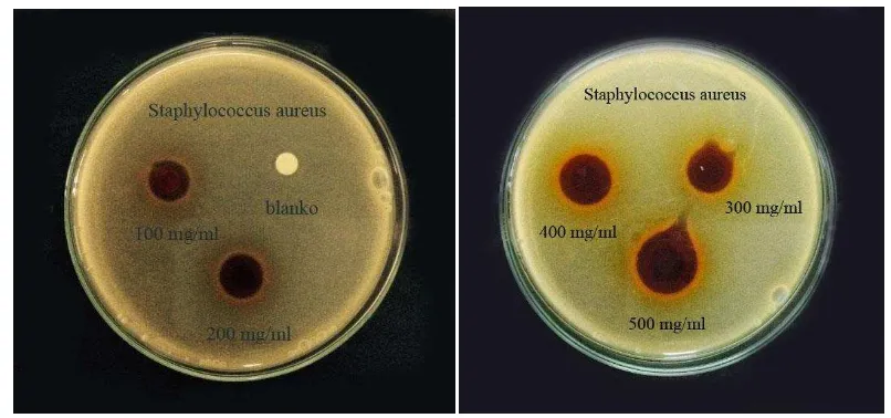Gambar 4.2 Zona hambat bakteri Escherichia coli. 