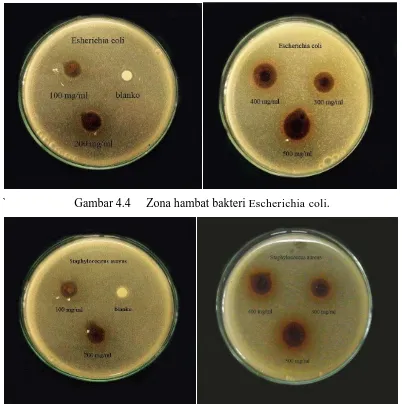 Gambar 4.4 Zona hambat bakteri Escherichia coli. 