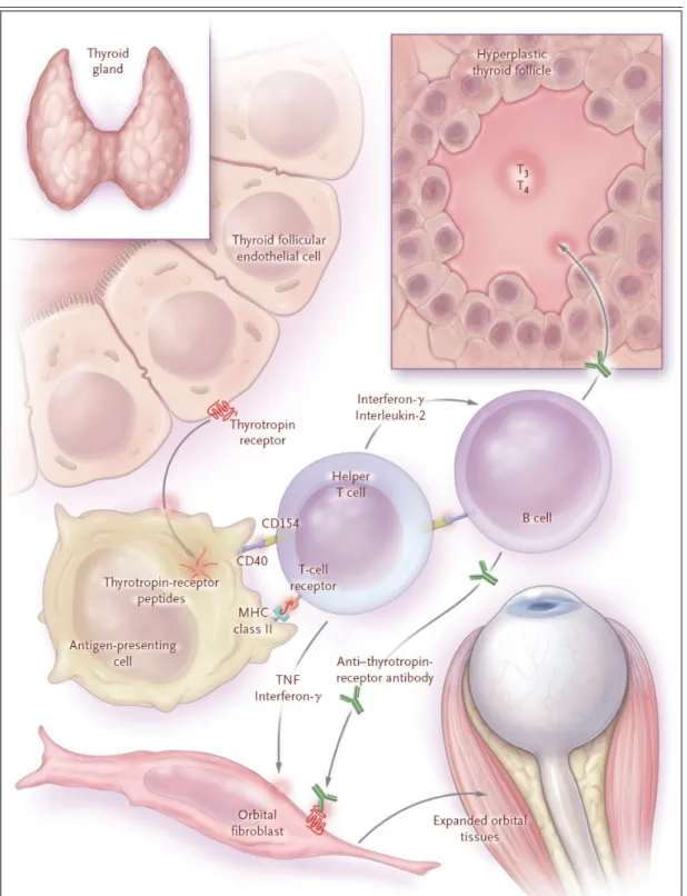 Gambar 1. Patogenesis Oftalmopati Graves (diambil dari jurnal Mechanism of disease Grave’s Ophthalmopathy, NEJM)