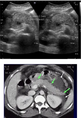 Foto polos abdomen  dan USG biasa dilakukan  pada pasien dengan kecurigaan  pankreatitis akut