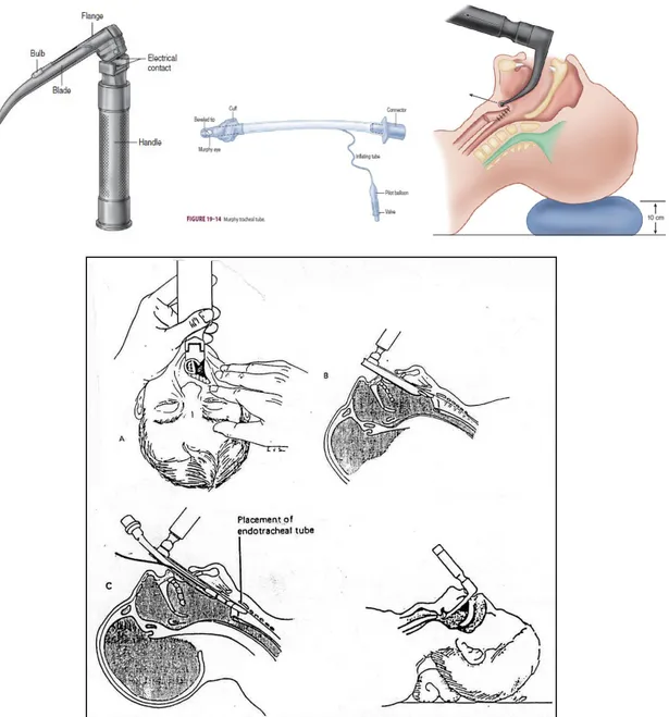 Gambar 4. Laringoskop, Endotrakeal Tube  dan Intubasi 