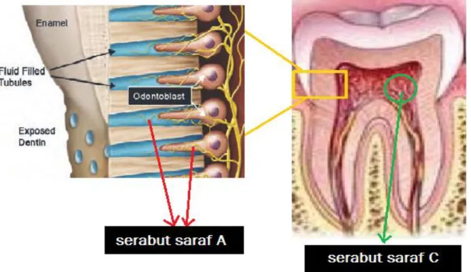 Gambar 1. Reseptor Nyeri: Serabut Saraf A dan Serabut Saraf C 