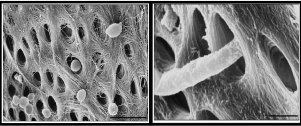 Gambar 1. Scanning electron dari blastospora C. albicans (A) dan (B) penetrasi hifa     ke dalam tubulus dentin pada saluran akar in vitro