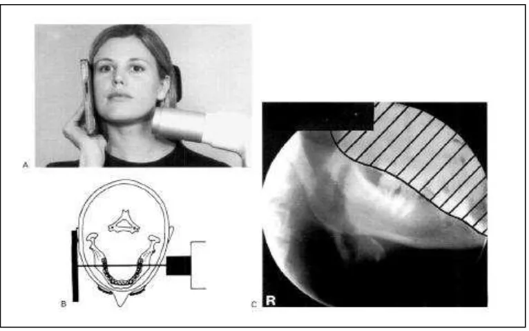 Gambar 5.   A. Posisi kaset dan tubehead Sinar-X untuk kaninus kanan mandibula dan maksila