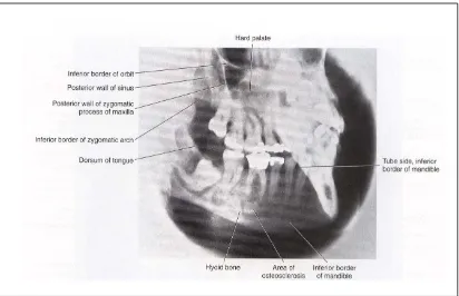 Gambar 7.  Gambaran anatomis bodi mandibula yang diidentifikasi dengan proyeksi lateral oblique.14 