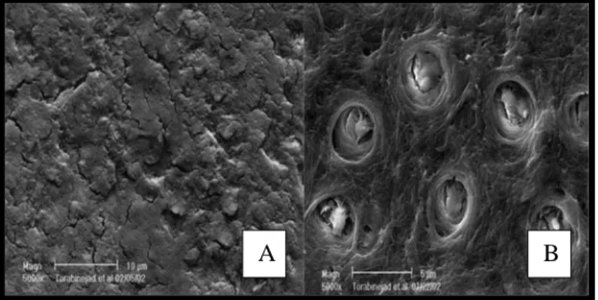 Gambar 1.   A.  Kehadiran  smear layer  pada permukaan  pertengahan saluran akar yang diirigasi  dengan NaOCl 5,25% dan irigasi final  dengan larutan yang sama