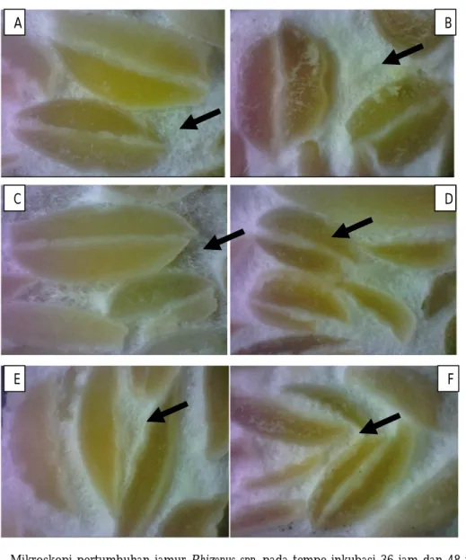 Gambar  1.  Mikroskopi  pertumbuhan  jamur  Rhizopus  spp.  pada  tempe  inkubasi  36  jam  dan  48  jam