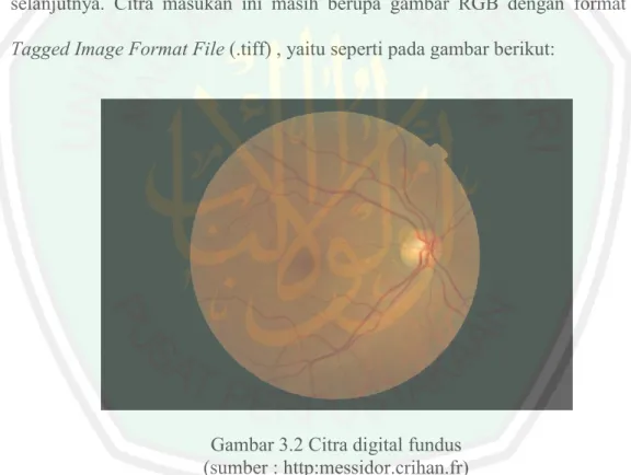 Gambar 3.2 Citra digital fundus  (sumber : http:messidor.crihan.fr) 