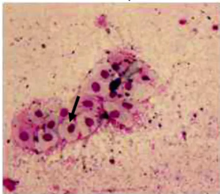 Gambar  1.  Sitologi  vagina  pada  pengamatan  hari  ke-1  kelompok  injeksi  diestrus  awal  ditandai  dengan  sel  epitel  parabasal  (panah  hitam)  perbesaran  200x 