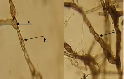 Gambar 4. Struktur hifa Cladosporium sp.; a. Ramokonidia; b. Konidiofor; c. Konidia 