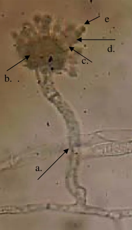 Gambar 7. Struktur hifa Aspergillus  sp.;  a. Konidiofor;  b. Vesikel; c. Metula;    