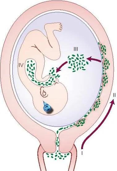 Gambar 2.2 Jalur infeksi intrauterin 