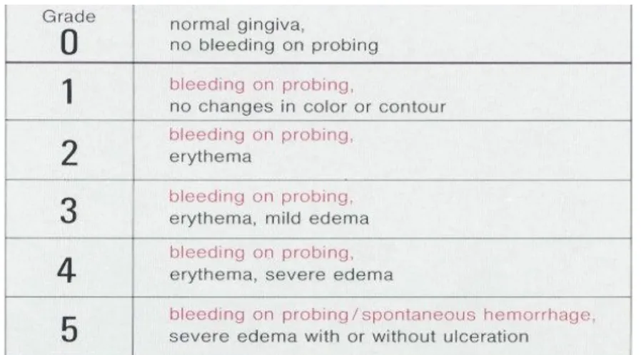 Gambar 5. Penilaian Sulcus Bleeding Index (Rateitschak dkk, 1985)