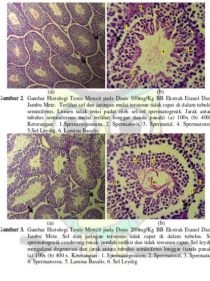 Gambar 2.  Gambar Histologi Testis Mencit pada Dosis 100mg/Kg BB Ekstrak Etanol Daun 