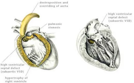 Ilustrasi oleh Dr. Gheorghe Constantinescu  (Kahn dan Line, 2008) 