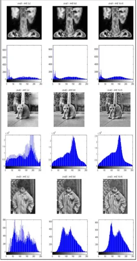 Gambar 10. Hasil ekualisasi histogram adaptif  (AHE) 2x2, 8x8, 16x16 piksel (2) 