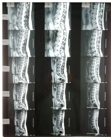 Gambar 2. Citra MRI Lumbal dengan variasi FOV pada potongan yang sama. 