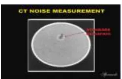 Gambar 1. Penghitungan nilai Noise menggunakan ROI 