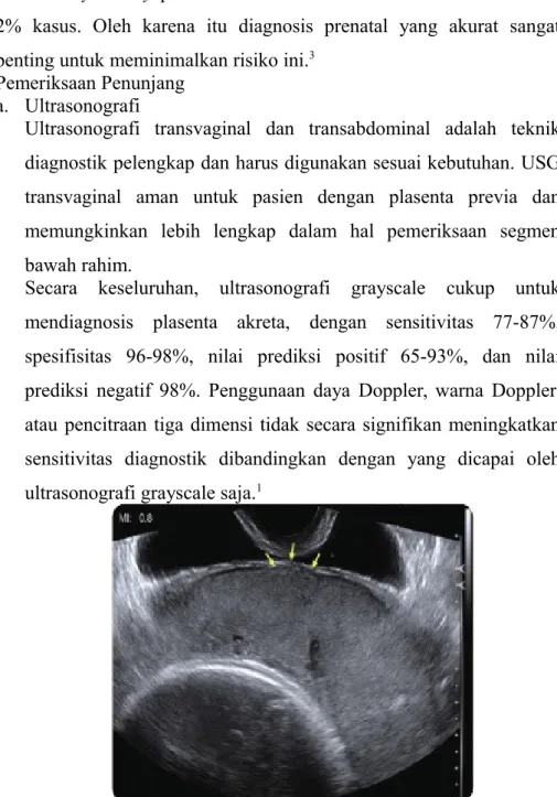 Gambar 1. Baris Echolucent yang sonographically: desidua basalis pembuluh   darah   dan   meluas   seluruh   panjang   plasenta