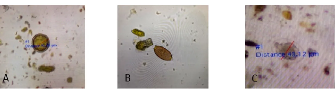 Gambar 1 Bentuk telur cacing nematoda yang menginfeksi saluran pencernaan M. maura dengan  pembesaran 40x : (A) telur cacing A