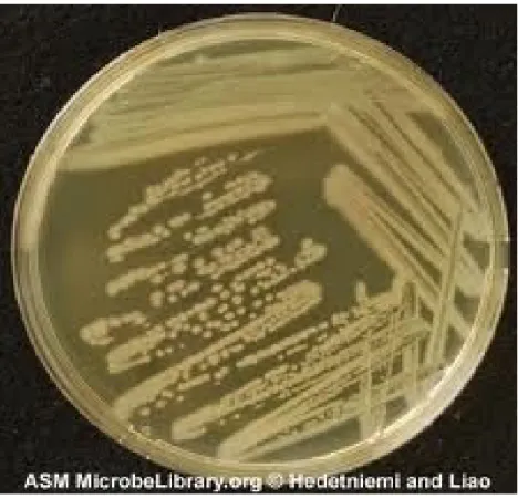 Gambar 2: Salah satu koloni Pseudomonas aeruginosa pada agar  