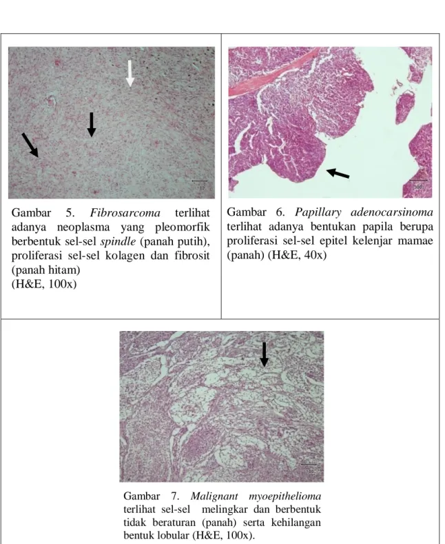 Gambar  6.  Papillary  adenocarsinoma  terlihat  adanya  bentukan  papila  berupa  proliferasi  sel-sel  epitel  kelenjar  mamae  (panah) (H&amp;E, 40x) 