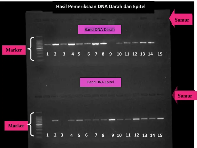 Gambar 1. Hasil Pita DNA diamati di Bawah Sinar UV  Keterangan:  1 = Standar  6 = Sampel Ichwan  11 = Sampel Yunus 