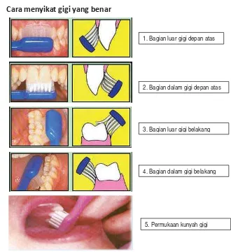 Gambar 7. Tehnik Menyikat Gigi        