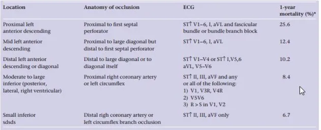 Tabel 3. Infark miokard akut berdasarkan EKG dan Angiografi  7