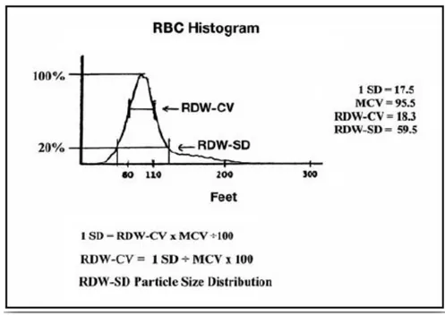 Gambar 2.2. Histogram penilaian RDW. RDW dinilai dari lebar  histogram pada 1 standard deviasi (1SD) dibagi nilai rerata MCV