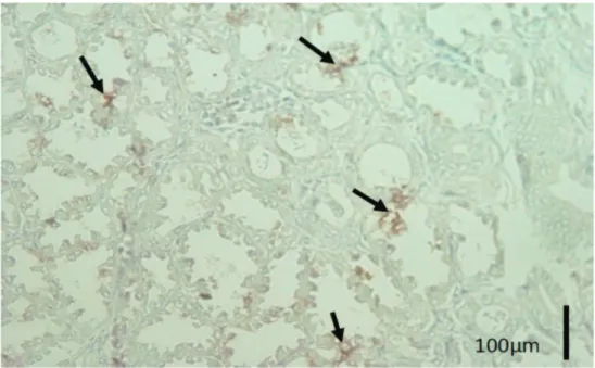 Gambar 2. Gambaran imunopatologis imunohistokimia streptavidin biotin dengan  antibodi poliklonal anti-nukleoprotein Newcastle disease virus (NDV)  pada ayam petelur komersial dengan gejala klinis tortikolis, paralisis kaki  dan hemoragis proventrikulus