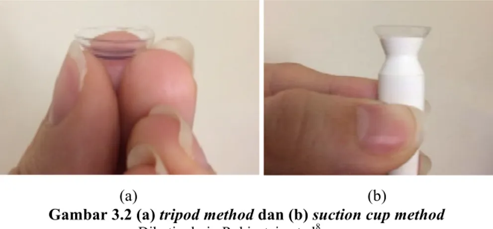 Gambar 3.2 (a) tripod method dan (b) suction cup method         Dikutip dari : Rubinstein et al 8