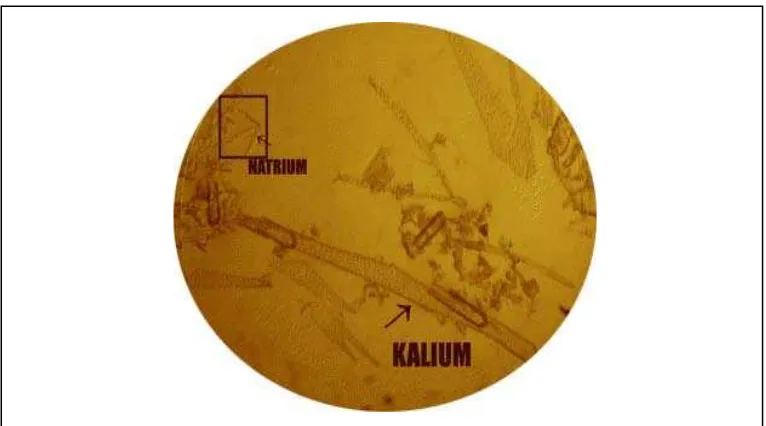 Gambar 3. Gambar Kristal Kalium  dan Natrium  dengan penambahan asam                       pikrat pada sampel Air kelapa Muda hijau  