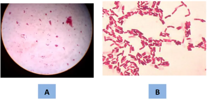 Gambar 1. Bentuk bakteri batang gram negatif pada mikroskop binokuler 