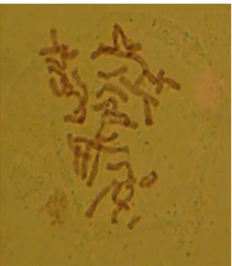 Gambar 6. Metafase pada Aglaonema “Butterfly” dengan metode sederhana Gambar  6  memperlihatkan  kromosom  aglaonema  butterflay  pada  saat  mitosis