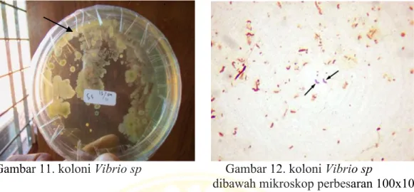 Gambar 11. koloni Vibrio sp    Gambar 12. koloni Vibrio sp            dibawah mikroskop perbesaran 100x10  Dari  hasil  uji  fisiologis  didapatkan  data  bahwa  bakteri  Escherichia  coli  ditemukan  disemua  lokasi  sampel