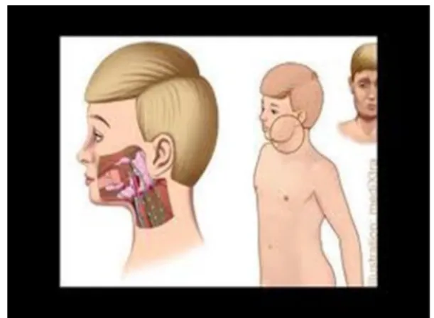 Gambar 7 : MUMPS