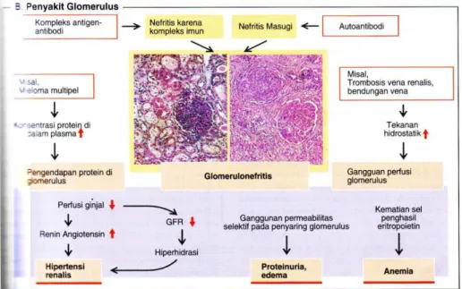 Gambar 1. Penyakit Glomerulus 