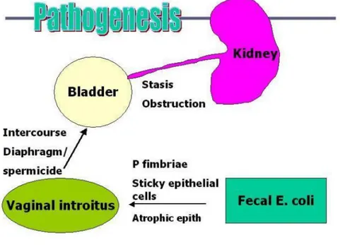 Gambar 4. Patogenesis Uropathogenic E. Coli menyebabkan terjadinya Cystitis ( Seed,  2013) 