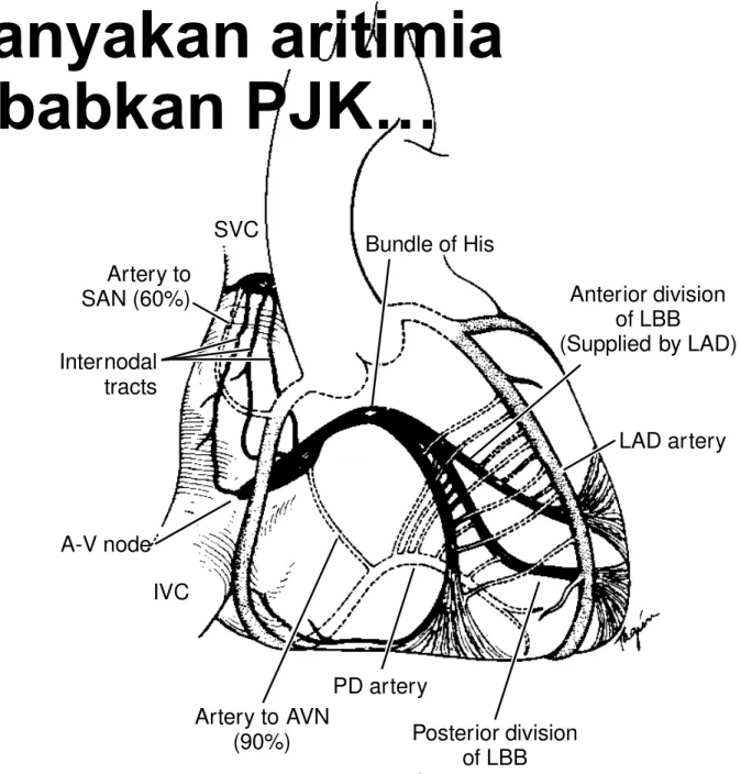 Figure 4-1  Drawing of t he anat omy of t he cardiac conduct ion sys- sys-t em including  arsys-t erial  blood  supply