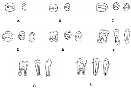 Gambar 11. Tahapan kalsifikasi gigi geligi (Demirjian dkk).28 
